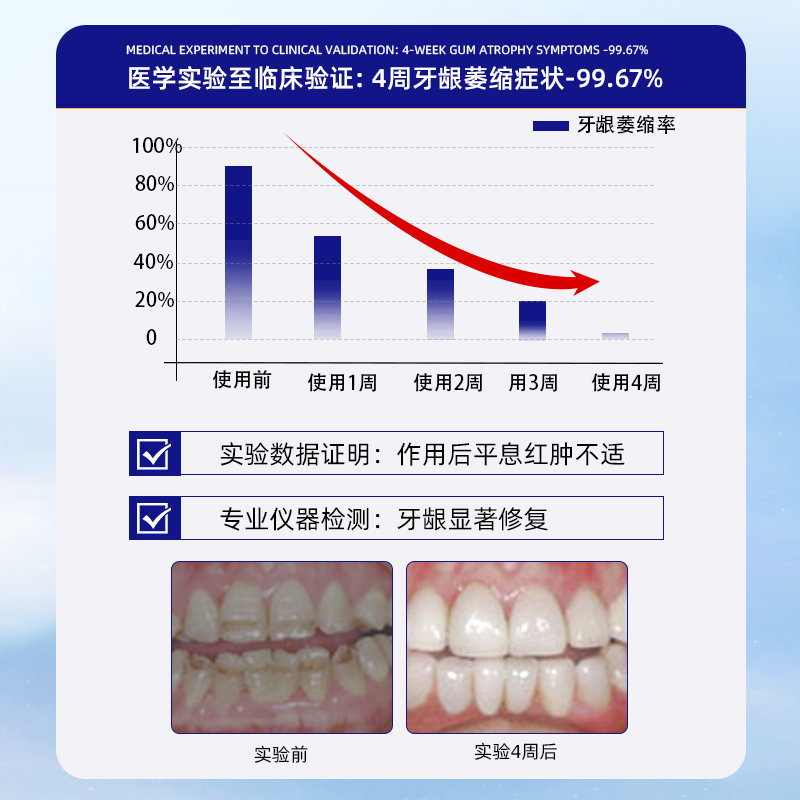 Zixinpu Pharmacy Medical-grade gingival atrophy special heavy repair regenerated silicon toothpaste periodontal anti-moth protection gum solid tooth inflammation toothpaste