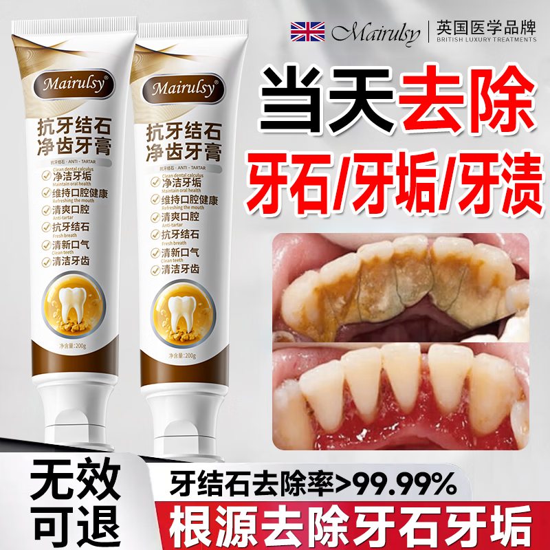 MAIRULSY British special toothpaste for removing calculus, removing bad breath, whitening, removing yellowing, removing tooth stains, removing tobacco stains and removing tartar, No. 1 on the gold list