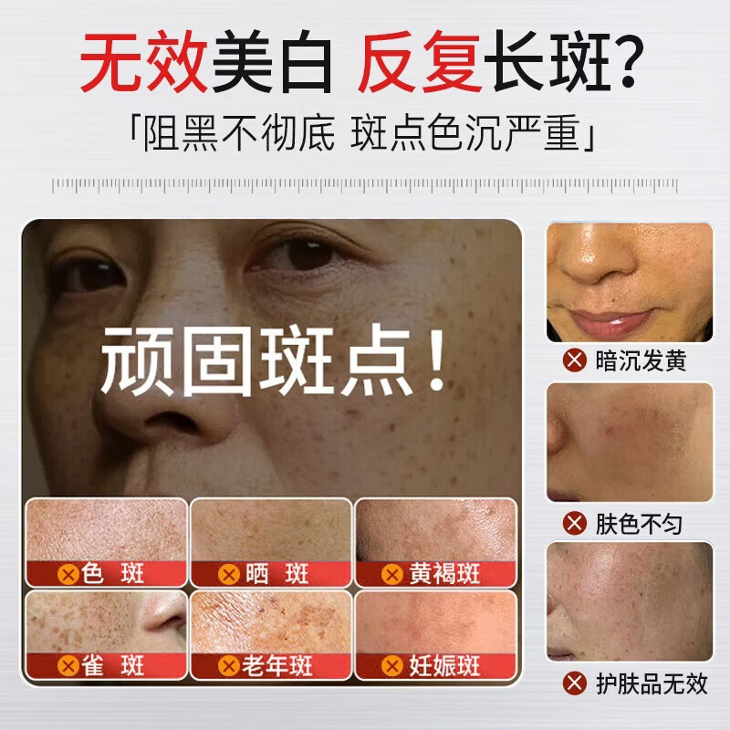 Touzhen 377 whitening and anti-freckle skin care product set, lightening melanin, brightening dullness, removing chloasma, anti-wrinkle and firming lotion