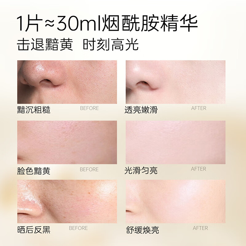 Uri's Niacinamide Brightening, Hydrating and Moisturizing Mask for staying up late, brightening skin tone, repairing sensitive skin, soothing, unisex