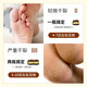 Wei Xiang'er Japanese horse oil hand and foot anti-crack cream 50g, autumn and winter removal of cracked feet, cracked hands, cracked heels, cracked cracks, moisturizing hand cream, universal for men and women