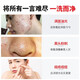 Nanjing Tong Ren Tang Acne Cleansing Milk Men and Women Youth Exfoliating Oil Control Blackhead Pore Shrinking Cleansing Milk 200g Chinese Valentine's Day