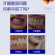 Warronson Medical Medical Tooth Pasta Gingival Atrofia Protección de protección de las encías especiales para los dientes sueltos y la fijación del diente Periodontitis Periodización severa antiinflamatoria Hinchazón y reparación del dolor Regeneración de la eliminación de incendios Protección de alivio de alivio Grado 3 Cajas de Grado 3
