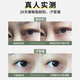 Sweat mandibular tumor removal cream fat particles removal tool oil particles removal white particles for men and women's eyes special eye cream in one box