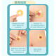 
Ostomy leak-proof ring plastic patch ring 12030 chassis leak-proof patch elastic glue 1 box/10 pcs M12042 leak-proof patch ring (4mm thick)