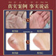 Tong Ren Tang Moisturizing Cracked Feet Cream, Cracked Hands, Cracked Heels Cream, Anti-freeze and Anti-Crack Cream, Cracked Feet Peeling Cream, 1 Bottle, Nourishing and Moisturizing Cream