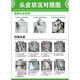 Chengliu Kopfhaut Haarfollikel Erkennung Bilder Haarwachstumsposter Haarstruktur Bild Werbung Haarausfall Grade Hängende Gemälde Kopfhaut FAQ 16852 PS Fotorahmen Malmalerei (Dicke 25 mm) 24 Zoll (40-60 cm)
