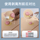 Nurse ClassMate Stoma Care Products Desproteo de spray Spray Chassis Remoción de gel Gel Spray Medical Adhesivo Medical 12010 50 ml (paquete mensual)