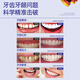 Warronson Medical Medical Tooth Pasta Gingival Atrofia Protección de protección de las encías especiales para los dientes sueltos y la fijación del diente Periodontitis Periodización severa antiinflamatoria Hinchazón y reparación del dolor Regeneración de la eliminación de incendios Protección de alivio de alivio Grado 3 Cajas de Grado 3
