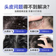 Baiyunshan Selenium Disulfid Shampoo Anti-Dandruff Anti-Chon-Kontrollölflausch und erfrischende silikonfreie Shampoo-Männer und Frauen 400 ml