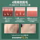 
KONKA (KONKA) Hair Removal Device Freezing Laser Hair Removal Device Painless Hair Removal Instrument Household Hair Shaver Whole Body Armpit Hair Removal to Boyfriend [Medical Star] Double Refrigeration + Red Light Strong Pulse Without Black + Stubborn Coarse and Hard