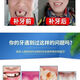 奇力康补牙材料永久医用补牙齿神器材料永久自己在家补牙材料临时补牙缝 967倍效【补15颗牙】爆丨款坚固不掉