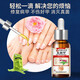 The No. 1 drug for onychomycosis in Hong Kong’s large pharmacy, dedicated for onychomycosis, fungal infection, removal of onychomycosis, new brightening of nail roots, antibacterial solution, 1 box, 1-2 recommendations
