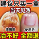 The No. 1 drug for onychomycosis in Hong Kong’s large pharmacy, dedicated for onychomycosis, fungal infection, removal of onychomycosis, new brightening of nail roots, antibacterial solution, 1 box, 1-2 recommendations