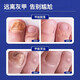 Hong Kong Pharmacy Co., Ltd. special onychomycosis removal, thickening, yellowing and emptying of onychomycosis, suitable for onychomycosis, Chinese herbal water antibacterial solution 30ml