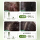 
HIEUAILR imported raw materials shampoo, anti-dandruff, anti-itchi, mites, acne control oil, lasting fragrance, fluffy, gold list for men and women [sweeping oil, mites, mites] 808ml*1