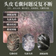 HIEUAILR German brand hair follicle cleaning shampoo anti-dandruff anti-itchi control oil fluffy mites remover men and women long-lasting fragrance cleaning cream [three bottles consolidation package] Deep cleaning farewell to mites acne