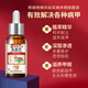The No. 1 drug for onychomycosis in Hong Kong’s large pharmacy, dedicated for onychomycosis, fungal infection, removal of onychomycosis, new brightening of nail roots, antibacterial solution, 1 box, 1-2 recommendations