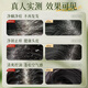 
HIEUAILR imported raw materials shampoo, anti-dandruff, anti-itchi, mites, acne control oil, lasting fragrance, fluffy, gold list for men and women [sweeping oil, mites, mites] 808ml*1
