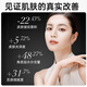 Beauty instrument firming and repairing skin rejuvenation and acne removal spectrometer facial mask household face mask whitening charging portable model [imported light beads] the same as 1048-Exclusive model [1048 beam] large row of lights