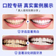 
Jiafuni Toothpaste Cleansing Tooth Whitening Fresh Tooth Brightening Tooth Men and Women Jiafuni Toothpaste Plus Fresh Flagship Two Packages*240g