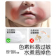 Cadyking Teether Baby empêche de manger des champignons de bâton de dentition de petit mois de la bouche de bébé bouchée à des dents style apaisant creux