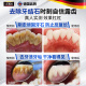 Sunoyar去牙结石牙膏口臭去黄去牙渍去烟渍牙垢清除牙结石溶解液护龈固齿