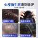 Lishikang sulfur shampoo anti-dandruff anti-oil control sulfur soap shampoo cream hair follicle seborrheic scalp teenager shampoo inflammation