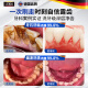 Sunoyar去牙结石牙膏口臭去黄去牙渍去烟渍牙垢清除牙结石溶解液护龈固齿
