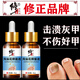 Correct impatiens onychomycosis antibacterial liquid, thick nails, bad nails, empty nails, yellowing, atrophy, discoloration, thickening and turbidity, fungal infection, impatiens onychomycosis antibacterial liquid 1 bottle
