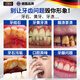 Sunoyar去牙结石牙膏口臭去黄去牙渍去烟渍牙垢清除牙结石溶解液护龈固齿