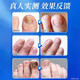 Baiyunshan Huacheng Onychomycosis 100% special effect medicine for nail fungal infection, removal of onychomycosis, thickening of onychomycosis, antibacterial potion, special effect 3 boxes, 90% selection, 2 get 1 free