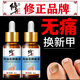 Correct impatiens onychomycosis antibacterial liquid, thick nails, bad nails, empty nails, yellowing, atrophy, discoloration, thickening and turbidity, fungal infection, impatiens onychomycosis antibacterial liquid 1 bottle