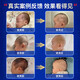 Bei Chuzhong shaped pillow for babies 0-6 months sleeping with round heads 0-1 years old baby pillow to correct lopsided head shape newborn child pillow white and blue 0-6 months 10A antibacterial maternal and infant grade 0-2-3 years old baby head shape correction adjustable drawstring summer machine washable medical