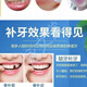 奇力康补牙材料永久医用补牙齿神器材料永久自己在家补牙材料临时补牙缝 967倍效【补15颗牙】爆丨款坚固不掉