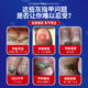 Higashida Japanese onychomycosis 100% genuine special fungal infection onychomycosis thickening, yellowing, thickening and empty 2 boxes suitable for moderate onychomycosis
