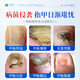 Xizi onychomycosis special effect root cream is specially used to treat nail fungal infection, remove the nail, make it yellow, thicken and thicken the antibacterial liquid.