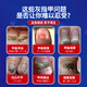 Miyamoto's onychomycosis 100% effective special medicine for severe onychomycosis fungal infection, nail removal, thickening, bad nail cream, antibacterial liquid 1 box, onychomycosis cream, No. 1 onychomycosis special effect