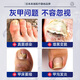 Japanese onychomycosis 100% effective special medicine. Severe onychomycosis imported fungal infection, bad nails turn yellow and thicken. Japanese special onychomycosis liquid 1 box, mildly suitable. No. 1 medicine onychomycosis 100% effective.