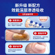 Miyamoto's onychomycosis 100% effective special medicine for severe onychomycosis fungal infection, nail removal, thickening, bad nail cream, antibacterial liquid 1 box, onychomycosis cream, No. 1 onychomycosis special effect