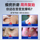 YANGMI wart removal ointment removes flat warts, filiform warts, and removes small fleshy particles on the neck. Salicylic acid wart removal ointment