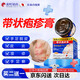 Songding Pharmaceutical's post-herpes zoster neuralgia, root-cutting, snake disc sore, rash, dermatitis, eczema, itching and itching, special non-drug