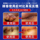 LA CHELLE hemorrhoid gel 100% special effect special plaster to remove the internal and external hemorrhoids, mixed hemorrhoids to remove the i meat balls, cut off the hemorrhoids at the root, 100% special effect one box hemorrhoids i ointment hemorrhoid gel special plaster to remove the hemorrhoids