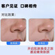 Xiaomi punta artefacto de limpieza de espinillas instrumento para espinillas chupa espinillas y acné limpia los poros instrumento súper succión limpiador de poros limpiador facial limpieza facial doméstica e instrumento de belleza blanco gran poder de succión + movimiento mejorado + algodón, excelente efecto/cinco cabezales de succión