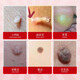 Hong Kong Jing Peitang wart and mole removal soap, small fleshy particles all over the body, flat neck, especially filamentous warts, antibacterial, wart removal, fly feces soap