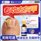 Jianbu Pharmaceutical onychomycosis special for severe nail fungal infection, removal of onychomycosis, thickening and yellowing health care solution 30ml