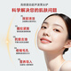 Minhuang Blackhead Remover Magic Electric Ultrasonic Peeling Machine Home Beauty Instrument Pore Cleaning and Blackhead Removal Upgraded Ultrasonic/EMS Deep Cleaning/LED Red and Blue Light Care
