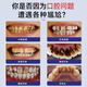 Moihanr German brand whitening toothpaste removes bad breath, yellow, tooth stains, smoke and stains, tartar, top ten well-known products containing fluorine-containing gum protection [2 packs] Long-term care, take away stubborn tooth stains