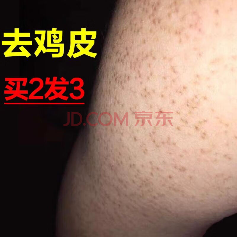 小腿有鸡皮疙瘩的男人命(为什么有的人腿上有鸡皮疙瘩)