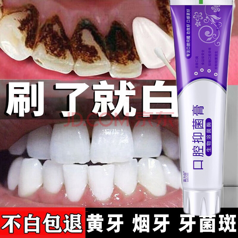 抖音网红hp口腔抑菌牙膏防臭口腔护理小苏打牙膏亮白牙齿去黄去渍护龈